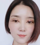 郑州人民医院整形科双眼皮案例恢复过程经验分享