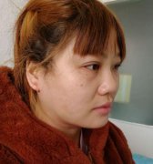 一个武汉大脸妹子在绎君整形吸脂瘦脸真实经历分享+医院医生资料一览